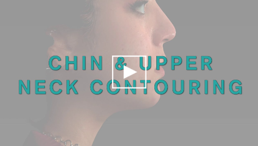 Chin and upper neck contouring video