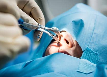 patient undergoing a nose surgery