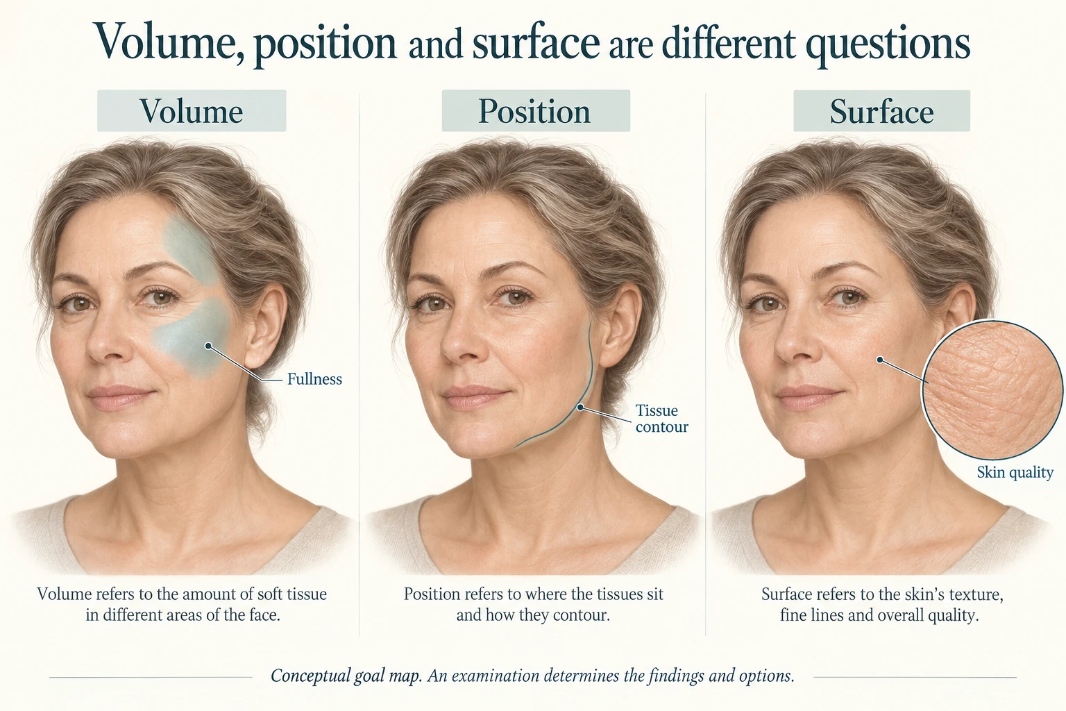 Three views of the same illustrated face separately highlight fullness, tissue contour and skin texture; these are not treatment comparisons.